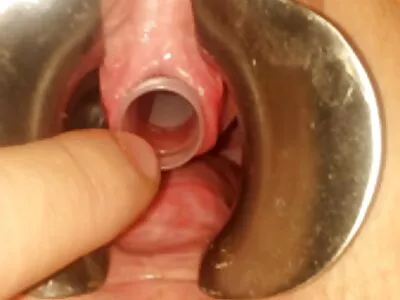 秃头黑人
